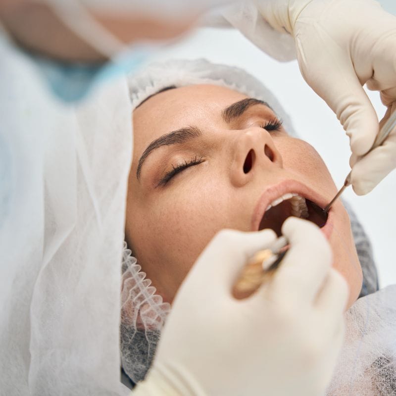 Soins Dentaires Généraux