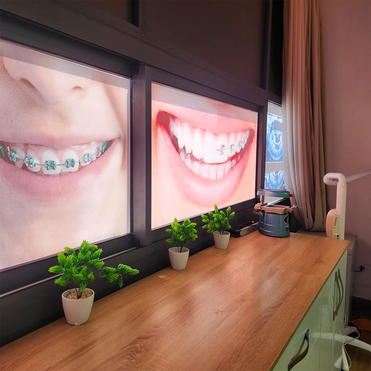 Sourire du patient après traitement